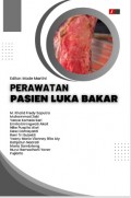 PERAWATAN PASIEN LUKA BAKAR (KARYA DOSEN DIII KEPERAWATAN) 2023